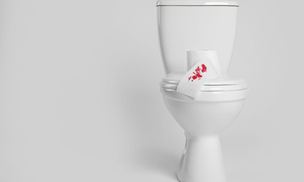 Sveža krv u stolici